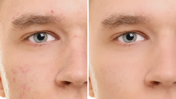 Photoshop elements la gi 6